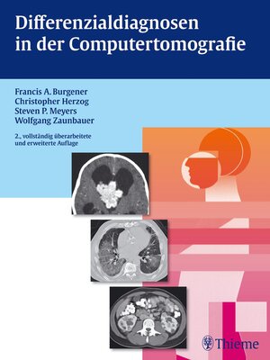 cover image of Differenzialdiagnosen in der Computertomografie